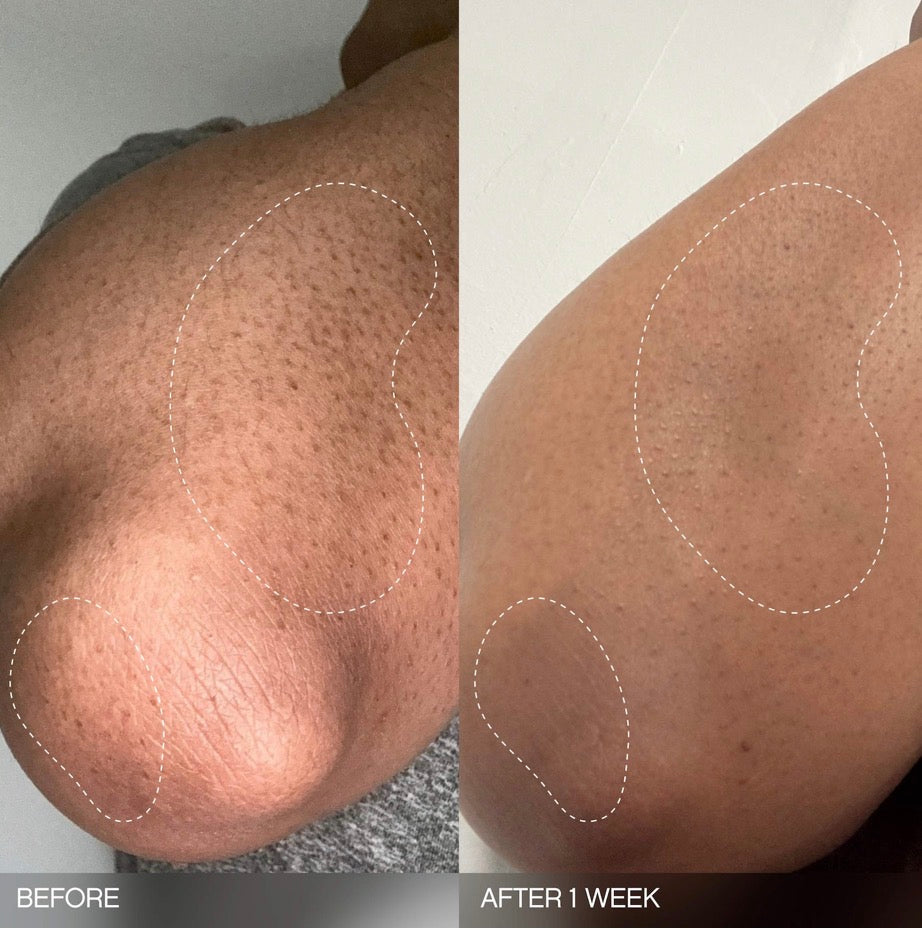 Duo Topicals Slather exfoliant